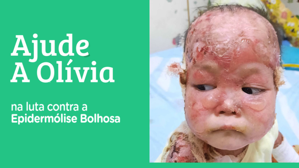 Olivia em tratamento